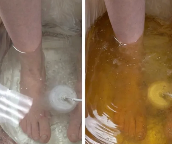 Side by side foot bath with clear water on one side and yellow water on the other .