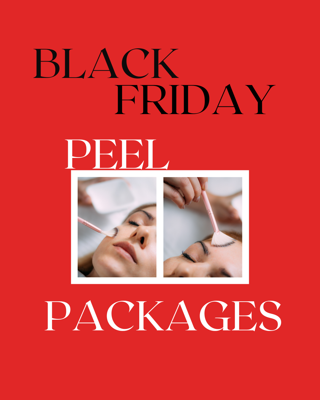 Advertisement for Black Friday peel packages with a red background and a small inset image of a facial treatment.